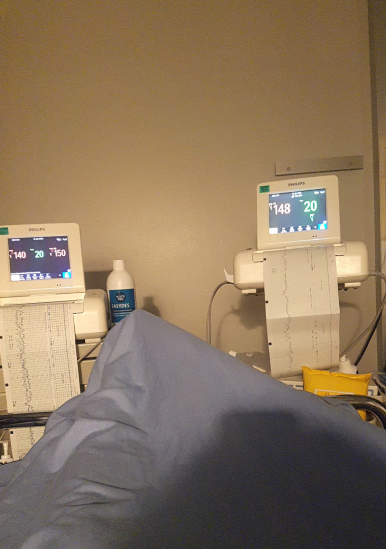 Kaksi sydänkäyrämonitoria sairaalasängyn päässä.