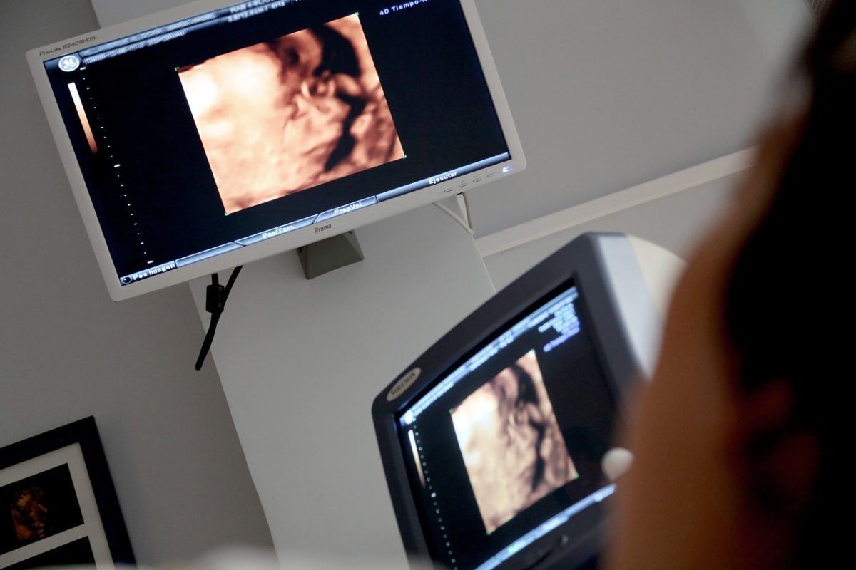 Ultraäänikuvat kahdella monitorilla.