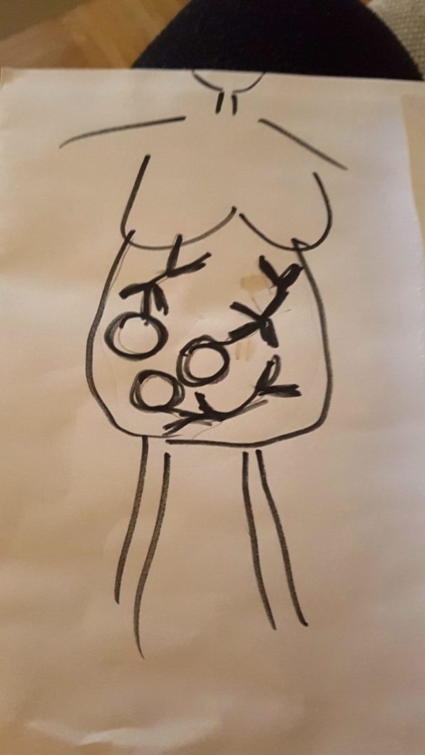 Piirretty tikku-ukko ilman päätä, vatsassa kolme tikku-ukkovauvaa.